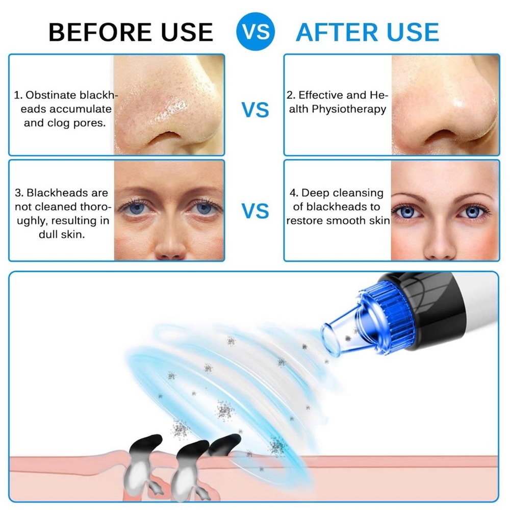 Pore cleaners machine